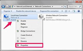 Image result for Local Area Connection