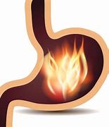 Image result for gastritis