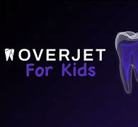 Image result for Overjet Children