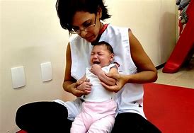 Image result for Microcephaly Newborn