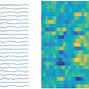 Image result for 3HZ Spike and Wave