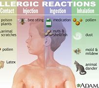 Image result for Immune System Allergies