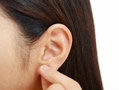 Image result for Crease On Earlobe as Sign of Heart Disease