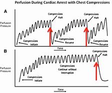 Image result for Recover Initiative CPR