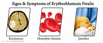 Image result for Erythroblastosis