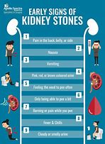 Image result for Kidney Stone Diagnosis