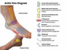 Image result for ankle pain diagrams