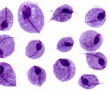 Image result for Trichomoniasis Microscope