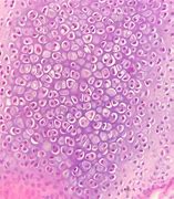 Image result for chondrocyt
