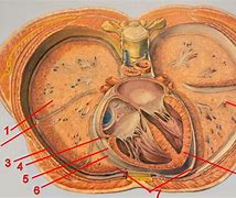 Image result for Thoracic Vent