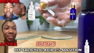 Image result for Salicylic Acid Solution