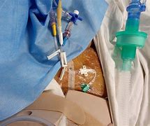 Image result for Central Venous Catheter Placement