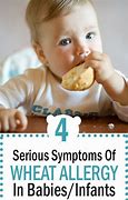 Image result for Baby Allergie Weisses Brot