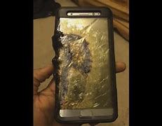 Image result for Samsung Note 7 Injuries