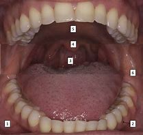 Image result for Tongue Epithelium