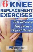 Image result for Knee Replacement Surgery Recovery