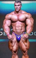 Image result for World's Biggest Muscles