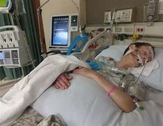 Image result for Woman On Life Support Image