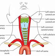 Image result for Left Carotid Artery Anatomy