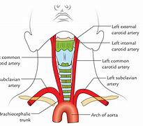 Image result for Carotid Artery Anatomy