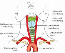 Image result for Carotid Artery in the Neck to Feel the Pulse