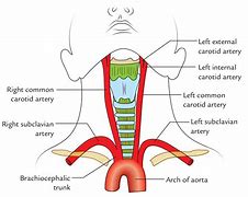 Image result for Internal vs External Carotid Artery