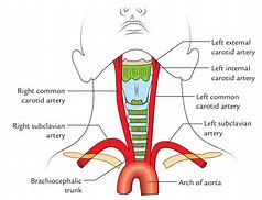 Image result for carotid artery anatomy