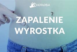 Image result for co_to_za_zapalenie_wyrostka_robaczkowego