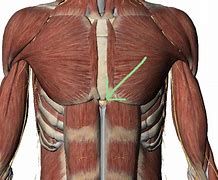 Image result for Lump Under Skin On Chest
