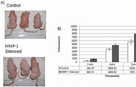 Image result for How Big Is 5 mm Tumor