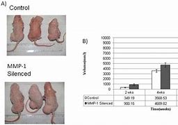 Image result for How Big Is 6Mm Tumor