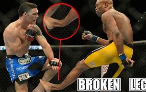 Image result for Bad Sports Injuries