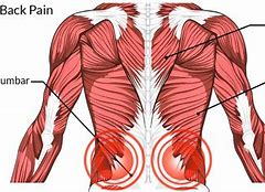 Image result for Lower Back Pain Location Chart