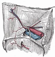 Image result for Femoral Artery Bypass Surgery