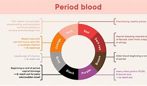 Image result for Dark Red Blood Fetal Death