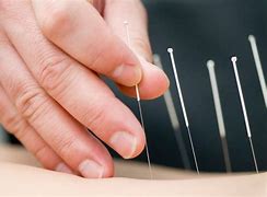 Image result for Acupuncture Wallpaper