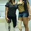 Image result for Amputee Leg Brace