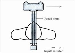 Image result for 1st Generation CT Scanner