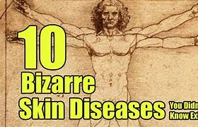 Image result for Scary Skin Diseases