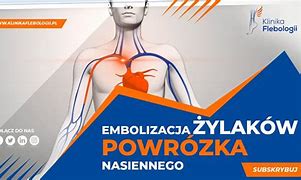 Image result for co_to_znaczy_Żylaki_powrózka_nasiennego