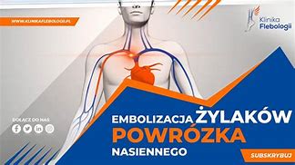 Image result for co_to_za_Żylaki_powrózka_nasiennego