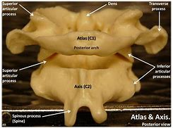 Image result for Cervical Vertebrae Atlas Axis