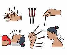 Image result for Acupuncture Cartoon