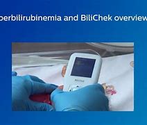 Image result for Philips Natus Bili Patch