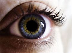 Image result for Yellow Ring around Eyes