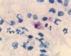 Image result for Chlamydophila Psittaci