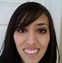 Image result for Messed Up Teeth with Braces