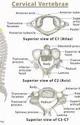 Image result for Cervical Vertebrae Labelled