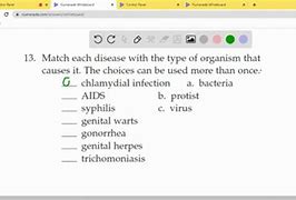 Image result for Trichomoniasis Differential
