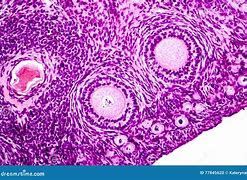 Image result for Ovary Microscopic View